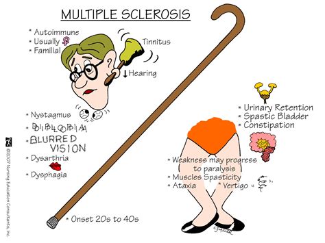 multiple sclerosis disease simplified  diagrams  medical students