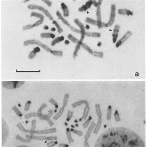 C Banded Karyotype Of Eupsophus Insularis A Examples Of Sex