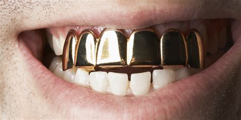 salvation army concerned  gold tooth donation  unintentional