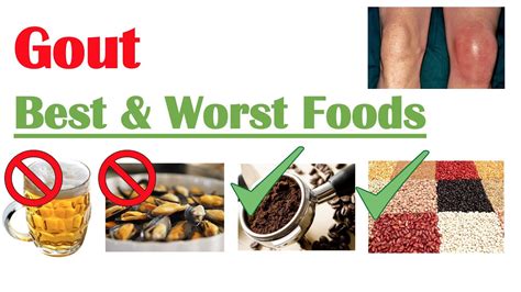 worst foods  eat  gout reduce risk  gout attacks