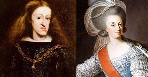 Royals Who Suffered From Hereditary Mutations And Defects