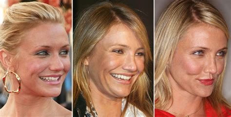 Cameron Diaz Nose Job Before And After Plastic Surgery Star Plastic