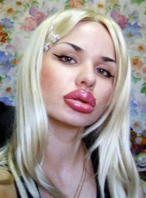 woman blows £4 000 on 100 lip boosters but says pout is still too