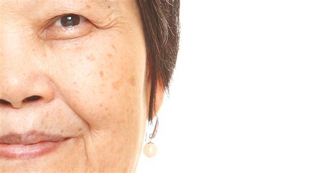Aging Skin Comprehensive Solution To Wrinkles Dry Skin Age Spots