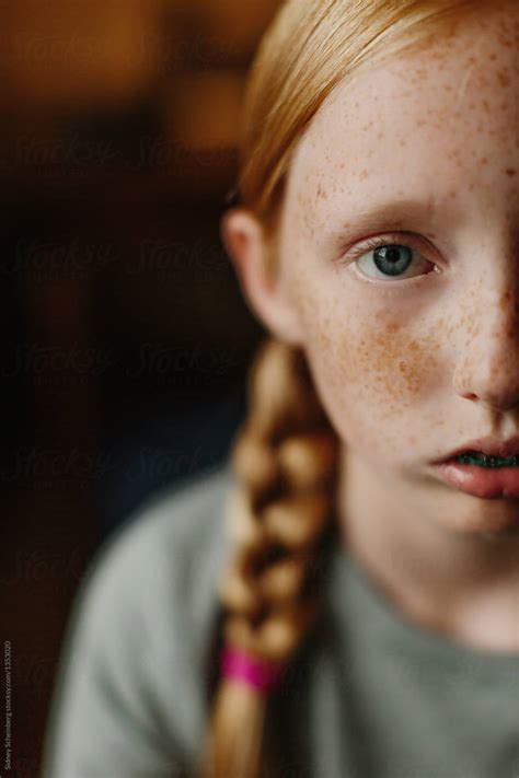 Freckles And Braces By Sidney Morgan Stocksy United
