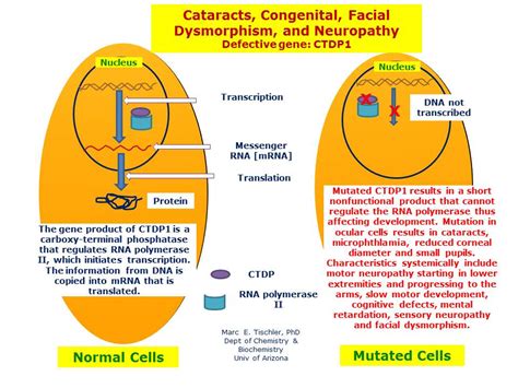 cataracts congenital facial dysmorphism and neuropathy hereditary