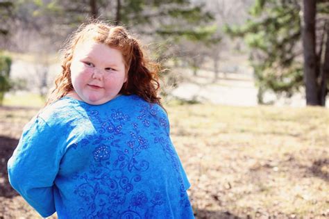 Morbidly Obese Texas Girl With Rare Condition To Get Gastric Bypass