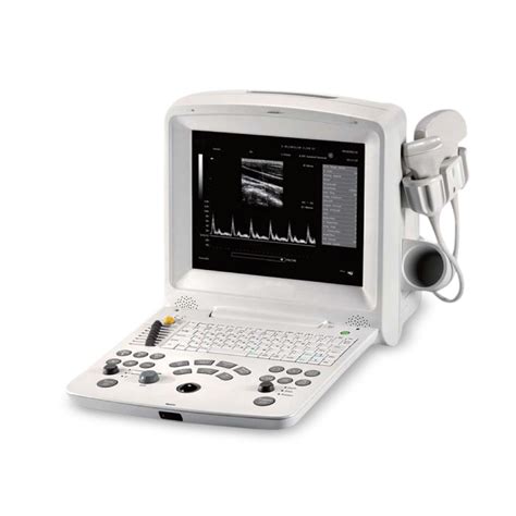 avante fs  advance digital ultrasound machine