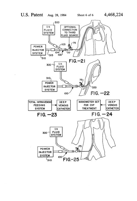 patent  system  method  catheter placement  blood vessels   human patient