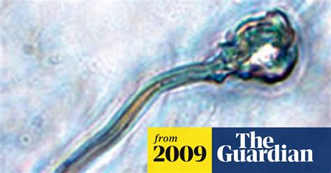 Scientists Claim Breakthrough In Growing Human Sperm From Stem Cells