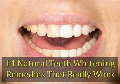 14 natural teeth whitening remedies that really work
