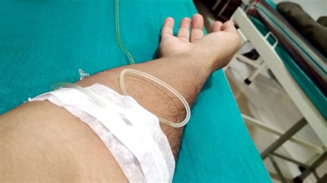 Close Up Image Of Iv Drip In Patient S Hand In Hospital 3813662 Stock