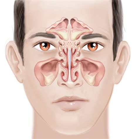 face sinusitis otolaryngology specialists  north texas