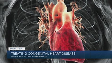 spectrum health raises awareness  congenital heart defects