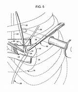 Patents Patent Bypass Coronary sketch template