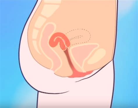Tilted uterus sex