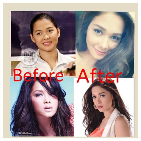 Health Insurance Before And After Maja Salvador