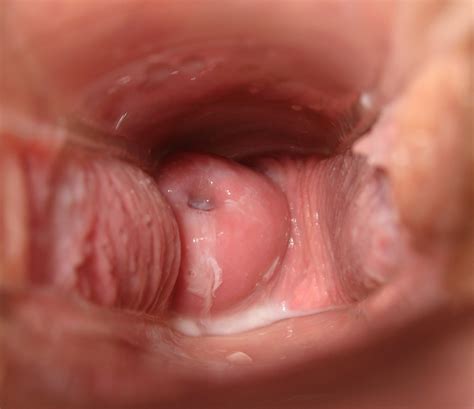 Sex cervix pain