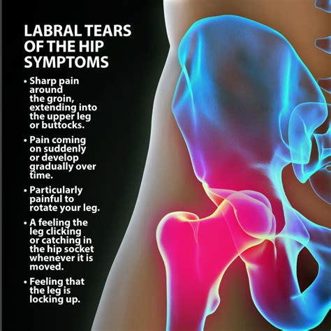 labral tears of the hip florida orthopaedic institute