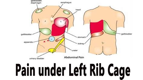 Picture Of What Is Under Your Rib Cage 14 Causes Of Pain
