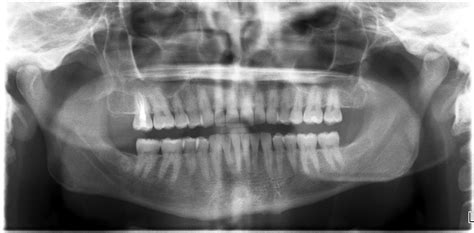 Borq Borq Kazemi Oral Surgery