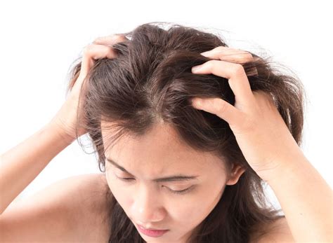 simple ways   rid   dry scalp salon invi