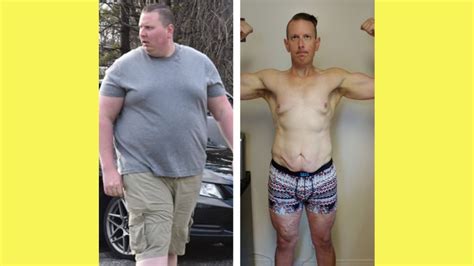 Life After Losing 150 Pounds Youtube