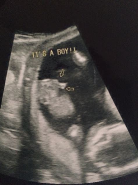 15 week gender ultrasound — the bump