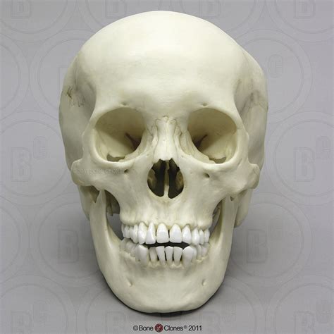 Human Adolescent Skull With Calvarium Cut Bc 301 Bc 305 S
