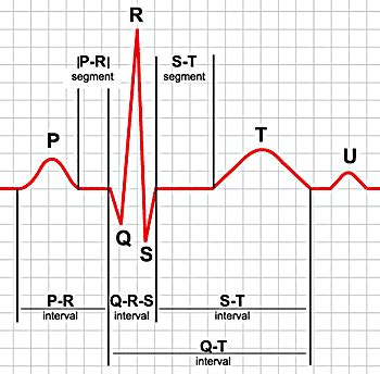 electrocardiograms ekgsecgs basic components   ekg tracing