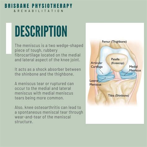 meniscus injury brisbane physiotherapy