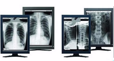 radiology  ray medical digital image monitor  ray diagnostic display