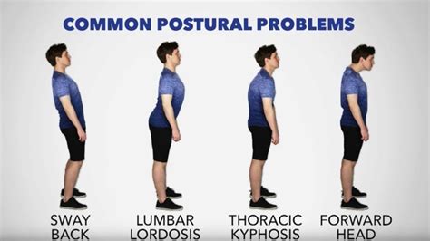 posture  poor  perfect   stretches  tips