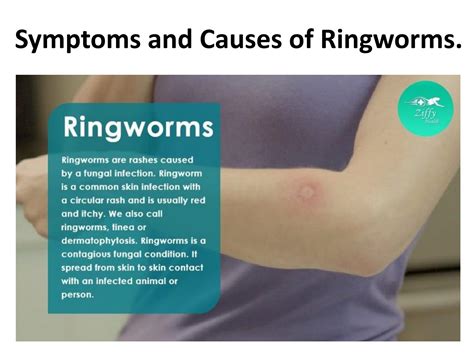 symptoms    ringworms  ziffytech issuu
