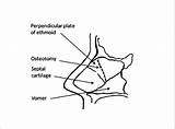 Figure Osteotomy Ethmoid sketch template