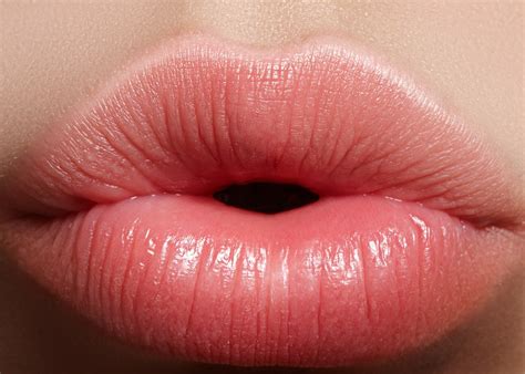 Botox Lip Flip Explained – 10 Things You Need To Know