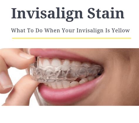 invisalign stains yellow teeth faq blog
