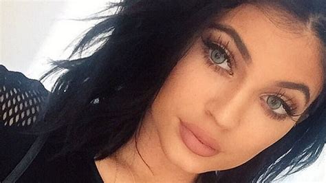 Kylie Jenner Admits Plump Lips Are Due To Fillers But Is