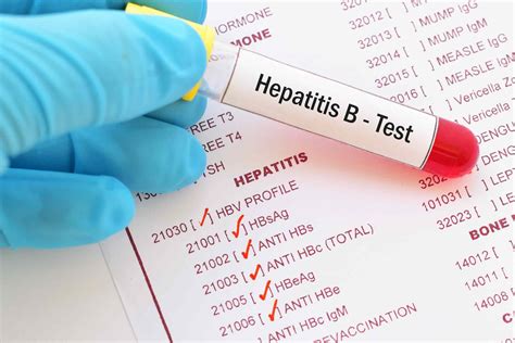 How Do I Get Tested For Hepatitis B Hbv