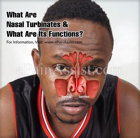 function  nasal turbinates   opt  turbinate reduction surgery