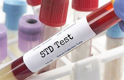 std test and hiv prevention worldmed center phi phi