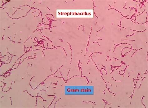 Streptobacillus Gram Stain Introduction Principle