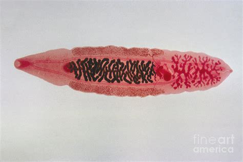 human liver fluke lm photograph  eric  grave