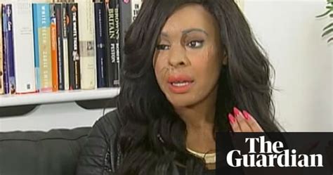 Acid Attack Victim Naomi Oni Police Added Insult To Injury Video