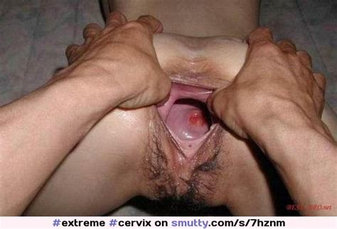 extreme cervix heldopen stretched pussy