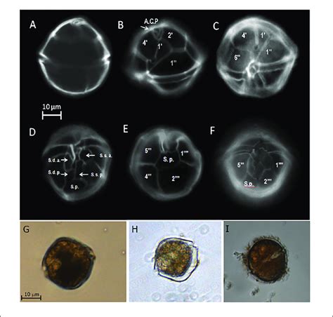morphological characteristics  alexandrium ostenfeldii collected   scientific