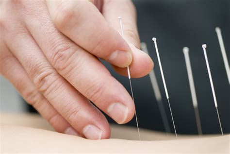acupuncture and herbal care