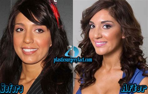 farrah abraham plastic surgery before and after breast implants and office girls wallpaper