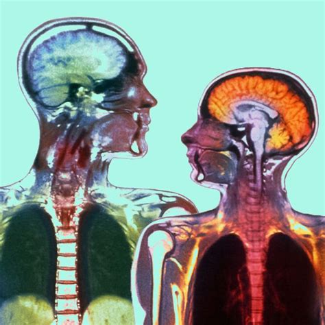 men s and women s brains appear to age differently