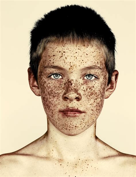 brock elbank s freckles shows off the true beauty of having freckles